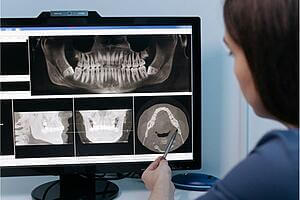 implants dentaires à calpe