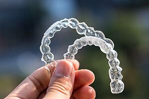 orthodontie invisible à calpe